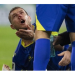 Edin Dzeko’nun, Romanya maçında burnu kırıldı