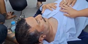 İYİ Partili Türkoğlu’na polis müdahalesi: Hastaneye kaldırıldı